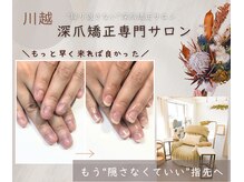 リネイル 川越(Re:NAIL)