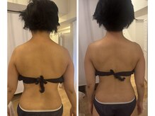 アエレ(AEREE retreat salon)の雰囲気（国産無農薬の和漢よもぎ蒸し×インディバセットも可◎）