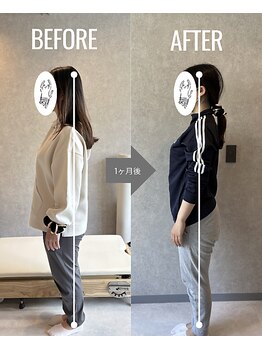 チュリ(Turi.)/30代女性　Before・After