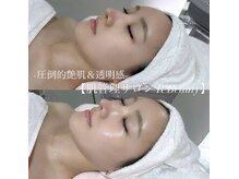アールビューティー 東新宿店(R’Beauty)