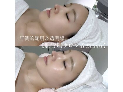 アールビューティー 東新宿店(R’Beauty)の写真