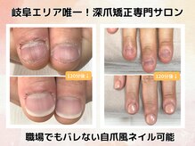 ブルームーンネイルズ(BLOOMOON.nails)の雰囲気（深爪改善を本気で目指す方の専門サロン（男性もご利用可能です））
