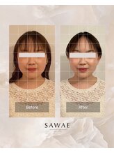 サワエギンザ(SAWAEGINZA)/before→after