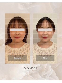 サワエギンザ(SAWAEGINZA)/before→after