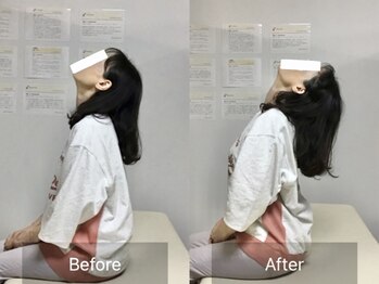 ナオル整体 国分寺院(NAORU整体)/50代女性【首・腰の不調】