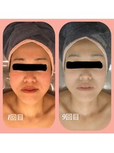 ウララン(URARAN)/コルギ９回目のお客様