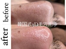 ヴィーヴ 京橋(vive)の雰囲気（夏は皮脂の分泌もアップ！毛穴ケアでスッキリ！メンズ大歓迎！）