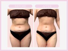 スリムライン 八戸店(The Slim Line)/before→after