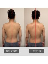 ツカ(TSUKA)/肩甲骨スッキリ背中美人