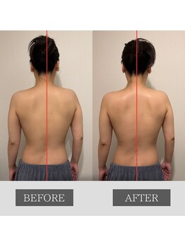 ツカ(TSUKA)/肩甲骨スッキリ背中美人