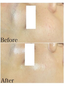 ブラックボックス(BLACK BOX)/30代女性のお客様