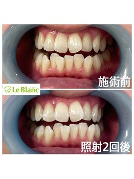 ルブラン 奈良店(Le Blanc)/縛りのない回数券!