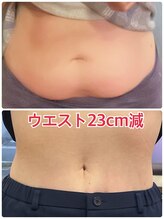 シュプリーム/50代　4ヶ月　12kg減！