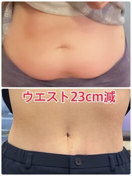 シュプリーム/50代 4ヶ月 12kg減!