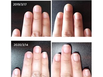 自爪ケア専門サロン イニュラ(inula)/自爪の成長記録