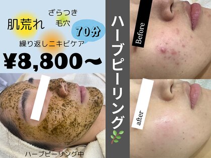 リンフェイス 表参道(RIN FACE)の写真