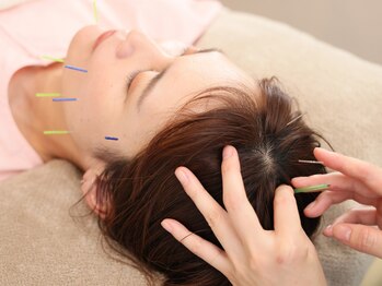 ときのはり鍼灸院(TOKINOHARI)の写真/7月NEWOPEN≪女性専用鍼灸院≫妊活・マタニティ・生理不調・更年期などに対応◇完全個室/20時迄営業◇