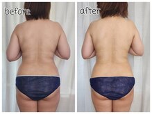 オリ(ORI)/リリースとフォース一回での変化