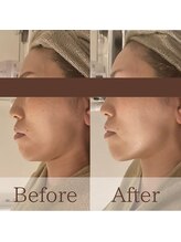 凪眠/小顔リンパフェイシャルの効果76