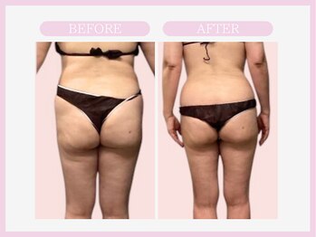 スリムライン 八戸店(The Slim Line)/before→after