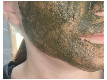洗顔サロン 池袋(SENGAN)の写真/【剥離ありハーブピーリング】お肌を根本から変えたい/しっかり結果を出したい方におすすめの集中ケア