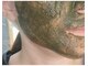 洗顔サロン 池袋(SENGAN)の写真/【剥離ありハーブピーリング】お肌を根本から変えたい/しっかり結果を出したい方におすすめの集中ケア