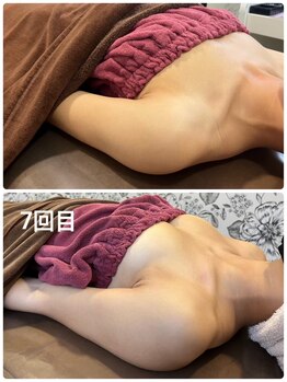 ロココ 豊田店(Rococo)/ビフォーアフター