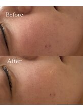 イヴトワエ(eiv Toi et A)/ 【プロが導く美肌循環】