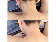 シュガーリングハウス ベル(Bell)の雰囲気(VIO・うなじ大人気!毛穴からツルツル角質オフ出来る脱毛♪)