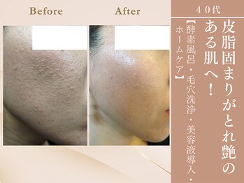 ケムズ インプルーブメントサロン(KMS IMPROVEMENT salon)/