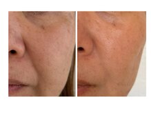 レジュイール(Rejouir)