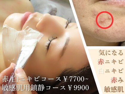 ハナ(HaNa)の写真