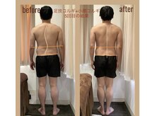 レアフィート(Rheafeet)/5回目の症例写真