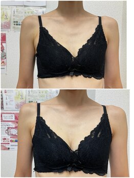 バーディー(BIRDIE)/施術１回/４０代ママ