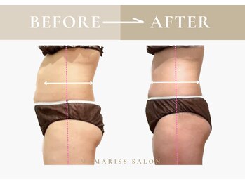 ママリスサロン(Mamariss Salon)/【痩身 5回 】