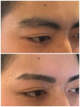 スリーピース(3Peace)/BEFORE／AFTER