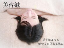 栖