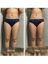 きこりのいずみ/上半身集中before-after