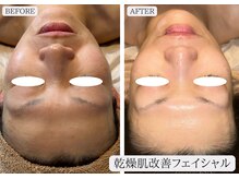 ルミア 函館店(LuMia)/乾燥肌改善◎ウルぷる水光肌へ☆