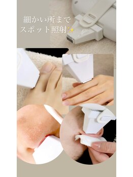 ハッピーエンジェル(Happy Angel)/【業界初】スポット照射