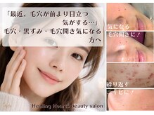 ヒーリングハーツ(Healing Hearts)