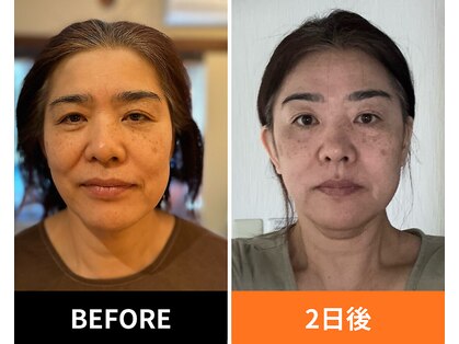ハーボプラス(THE HEARBO plus)の写真