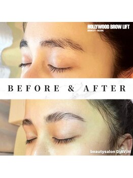ディアビム(DiAViM)/＊ハリウッドブロウリフト＊