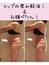 ビューティースパ/猫背/お尻の厚み/お腹凹みました