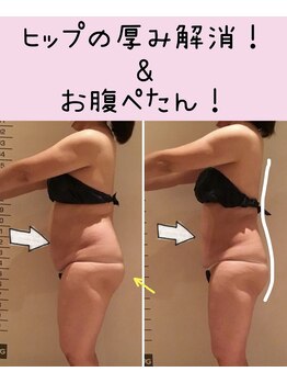 ビューティースパ/猫背/お尻の厚み/お腹凹みました