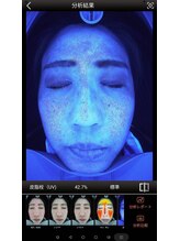 ミーシェ(Meshie)/AI肌診断機