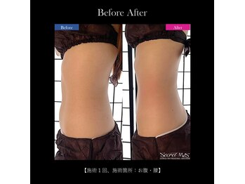 ミモサ 川中島温泉テルメDOME内(mimosa)/