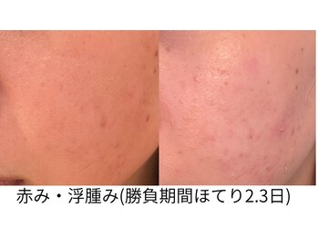 ラビエス(LAVIES)/【勝負期間】当日～２日