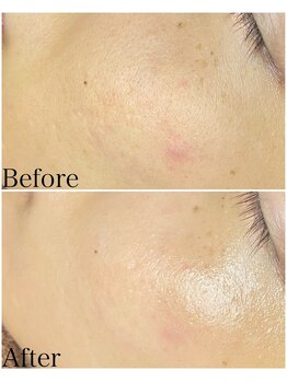 ブラックボックス(BLACK BOX)/30代女性のお客様