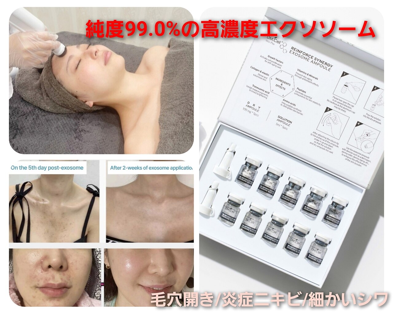 フェイシャルボーテ エスボーテ(sbeaute)｜ホットペッパービューティー